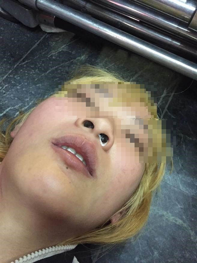 1050420女毒蟲倒路旁 熱心警救護反查毒(圖示)